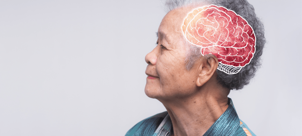 Age-associated memory impairment doesn’t mean you have dementia.