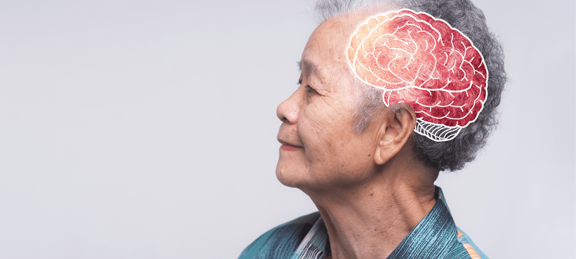 Age-associated memory impairment doesn’t mean you have dementia.